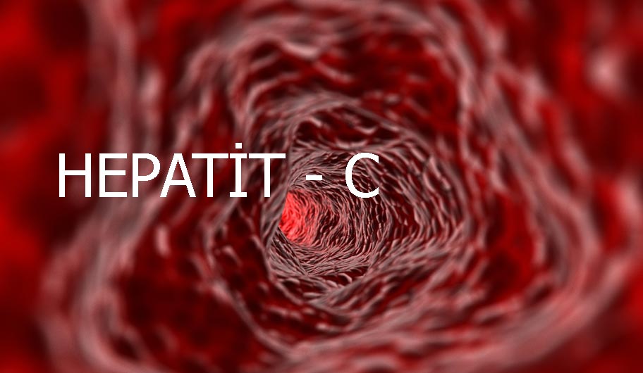 Hepatit C>