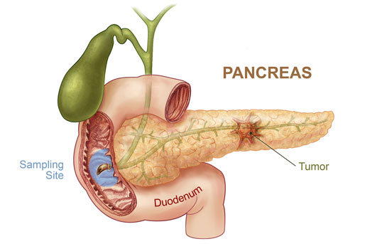 Pankreası Çalıştırma>